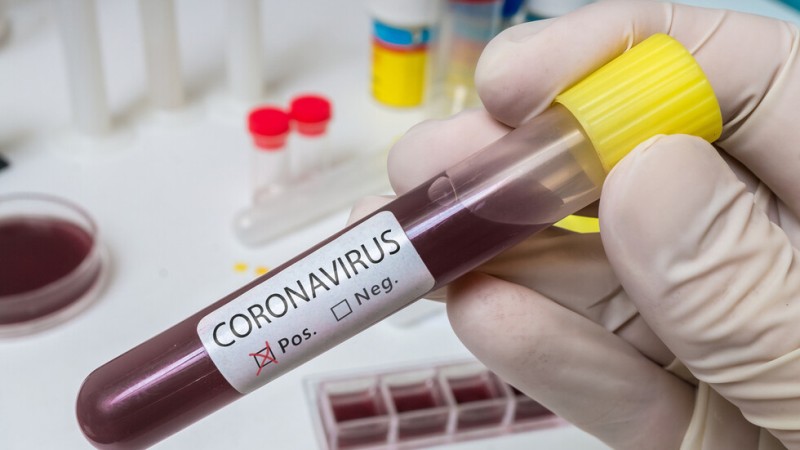 Регистрираха 17 нови случая, заразените с коронавирус у нас са 293