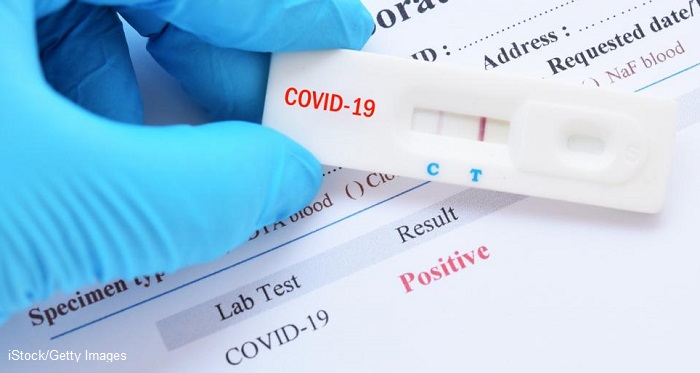 9 нови случая на коронавирус в Бургаско