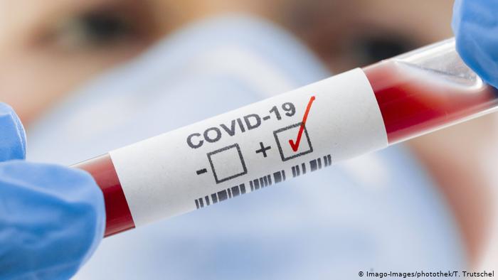 Испания с най-много смъртни случаи от COVID-19 за 24 часа