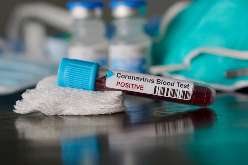 Броят на болните от коронавирус у нас стигна 422 души