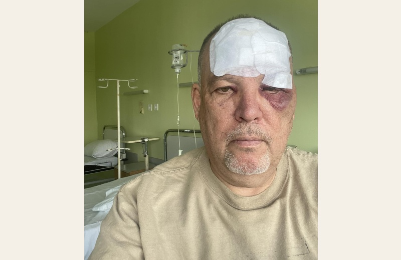 Бургаският адвокат Иво Баев е приет в болница насинен