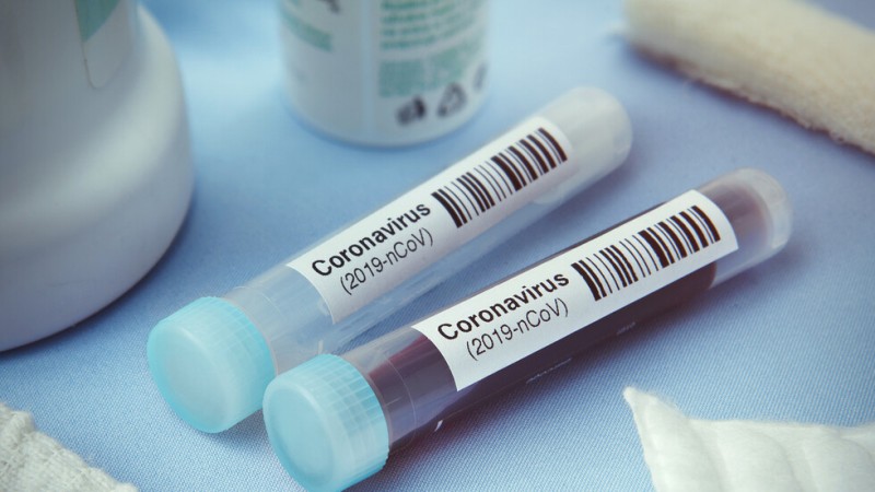Осемте проби, изследвани за коронавирус, са отрицателни