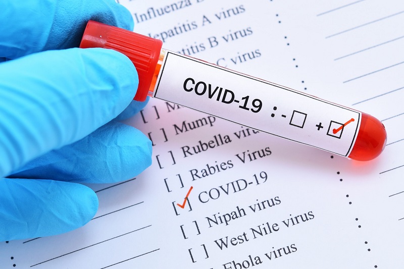 276 души починаха от коронавирус за денонощие