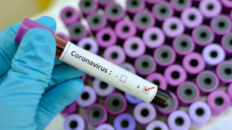 1891 са новите случаи на коронавирус у нас