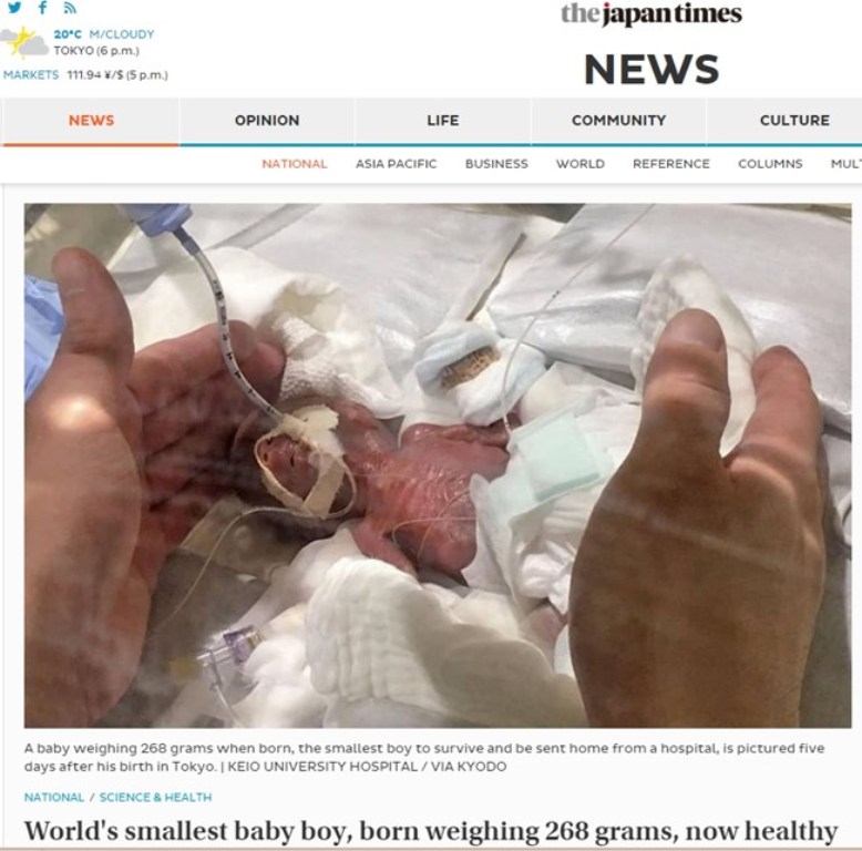 Момченце с тегло 258 грама се роди в Япония