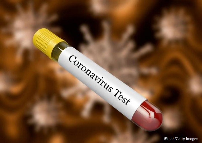 276 нови случая на коронавирус, излекуваните са 150