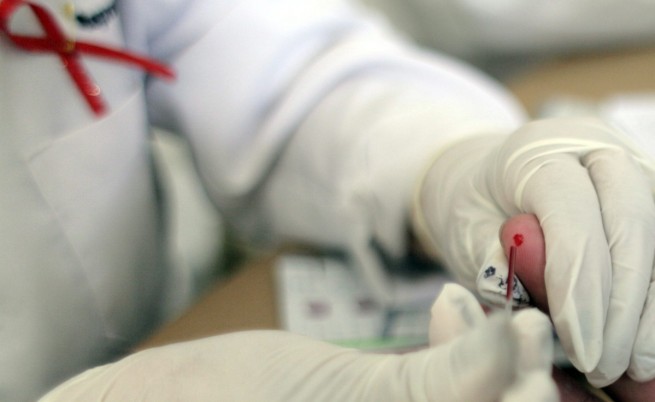 Първи случай на СПИН и втори на сифилис за годината в Бургас