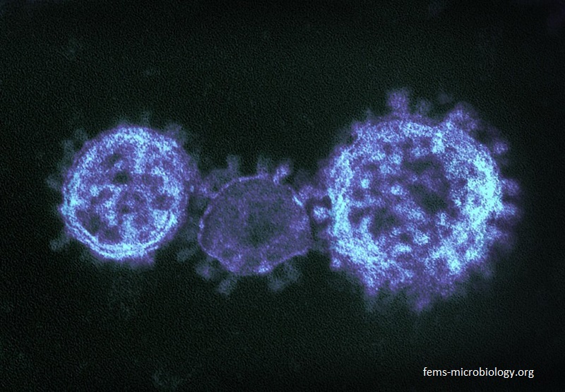 Учени установиха при каква температура коронавирусът загива