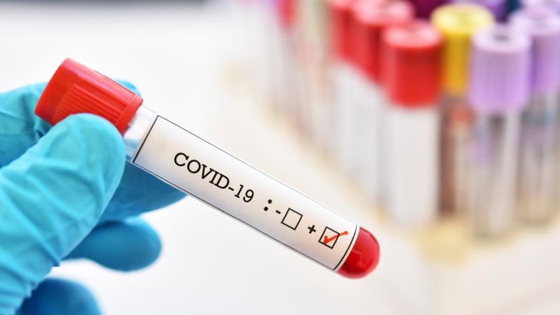Изравнен рекорд по починали с коронавирус в България