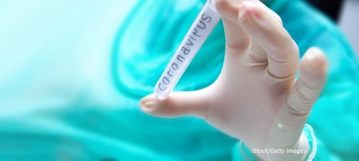500 са вече жертвите на коронавируса в Китай