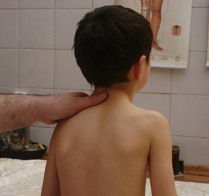 Безплатни прегледи за деца с гръбначни изкривявания