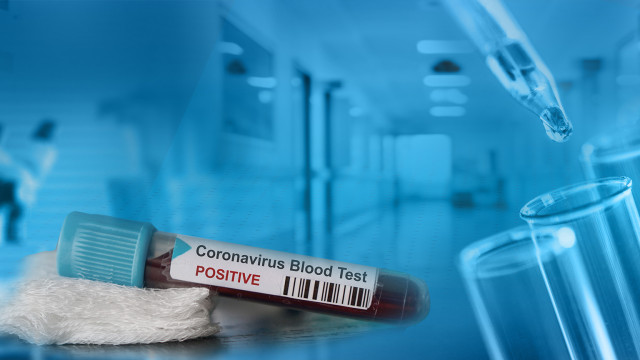 4 201 са новозаразените с коронавирус за денонощие в страната 