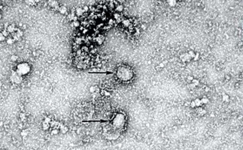 Ето го смъртоносния коронавирус