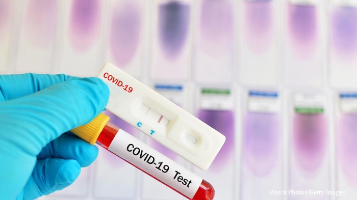 Коронавирусът днес: 189 потвърдени случаи при едва 2161 теста