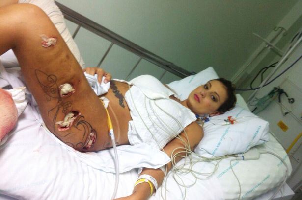 Бразилска ТВ красавица прекали с имплантите, има риск от ампутация на крака й 