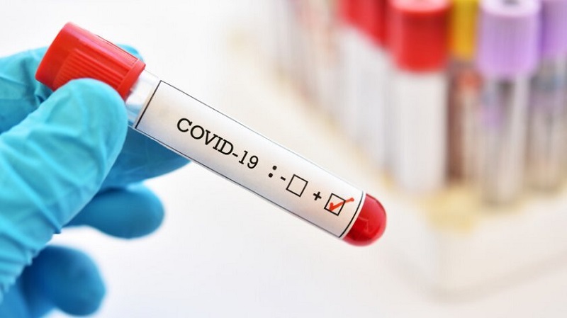 1 733 нoви случая на коронавирус за денонощие у нас