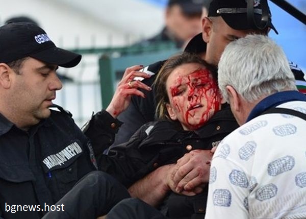 Посреднощ оперираха полицайката, ранена на мача Левски – ЦСКА